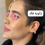 مطب زیبایی پوست و مو دکتر کوروش بزرگ ساوجی در سید خندان تهران