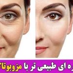 مرکز تخصصی vip لیزر موهای زائد لیلیوم در گوهردشت کرج