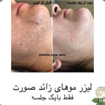 کلینیک زیبایی دلارز در گلشهر کرج