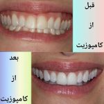 مطب دندانپزشکی و ایمپلنت دکتر رضا شکیبایی در سلسبیل تهران