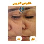 مرکز تخصصی خالبرداری رویا رضایی در ارومیه