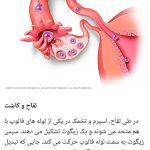 فروش مکمل های ناباروری تقویت اسپرم مردان آنلاین طب باروا در تبریز