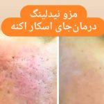 کلینیک تخصصی پوست و مو سوگند شکیبا در قائم شهر