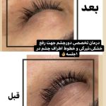 آموزش و خدمات تخصصی پاکسازی پوست سارا مزروعی در اصفهان