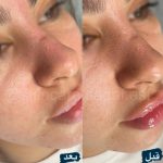 آموزش و خدمات تخصصی پاکسازی پوست صدف زنگنه در اصفهان