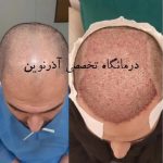 کلینیک تخصصی پوست و مو آذرنوین در هفده شهریور قدیم تبریز