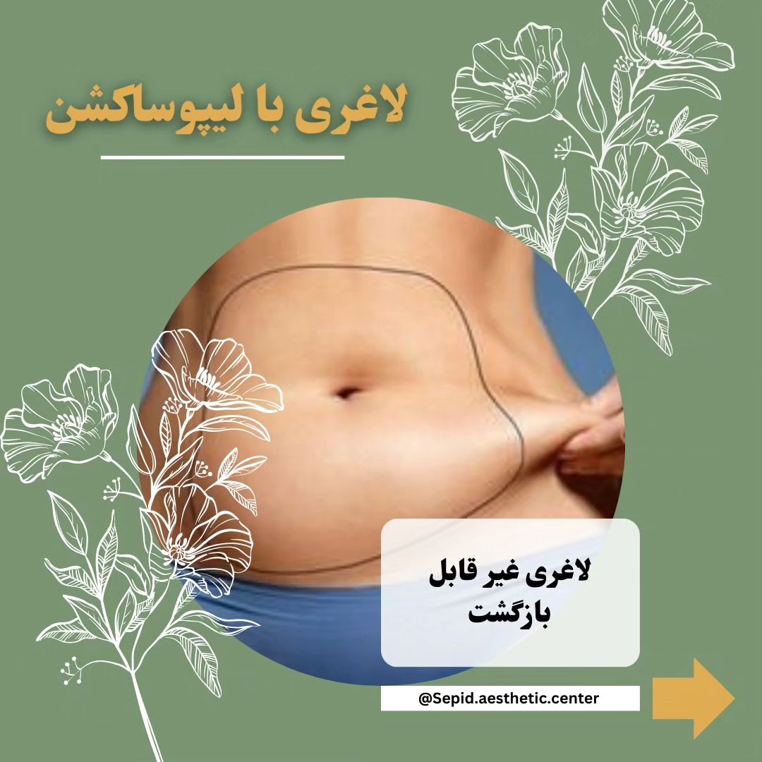 مرکز تخصصی زیبایی لیزر سپید در 17 شهریور تبریز 