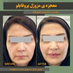 مرکز تخصصی زیبایی لیزر سپید در 17 شهریور تبریز