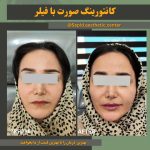 مرکز تخصصی زیبایی لیزر سپید در 17 شهریور تبریز