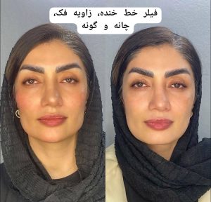 کلینیک زیبایی پوست و مو سارا در چالوس