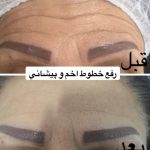 مرکز لیزر مهتاب در وهابی اهواز