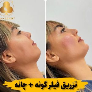 کلینیک زیبایی آس در چهارراه عمار یاسر ارومیه