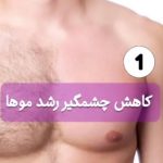 مطب vip لیزر موهای زائد ونوس در سه راهی ولیعصر تبریز