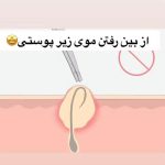 مرکز لیزر پرشین در یزد