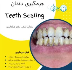 مطب دندانپزشکی دکتر محمود صادقیان در یزد