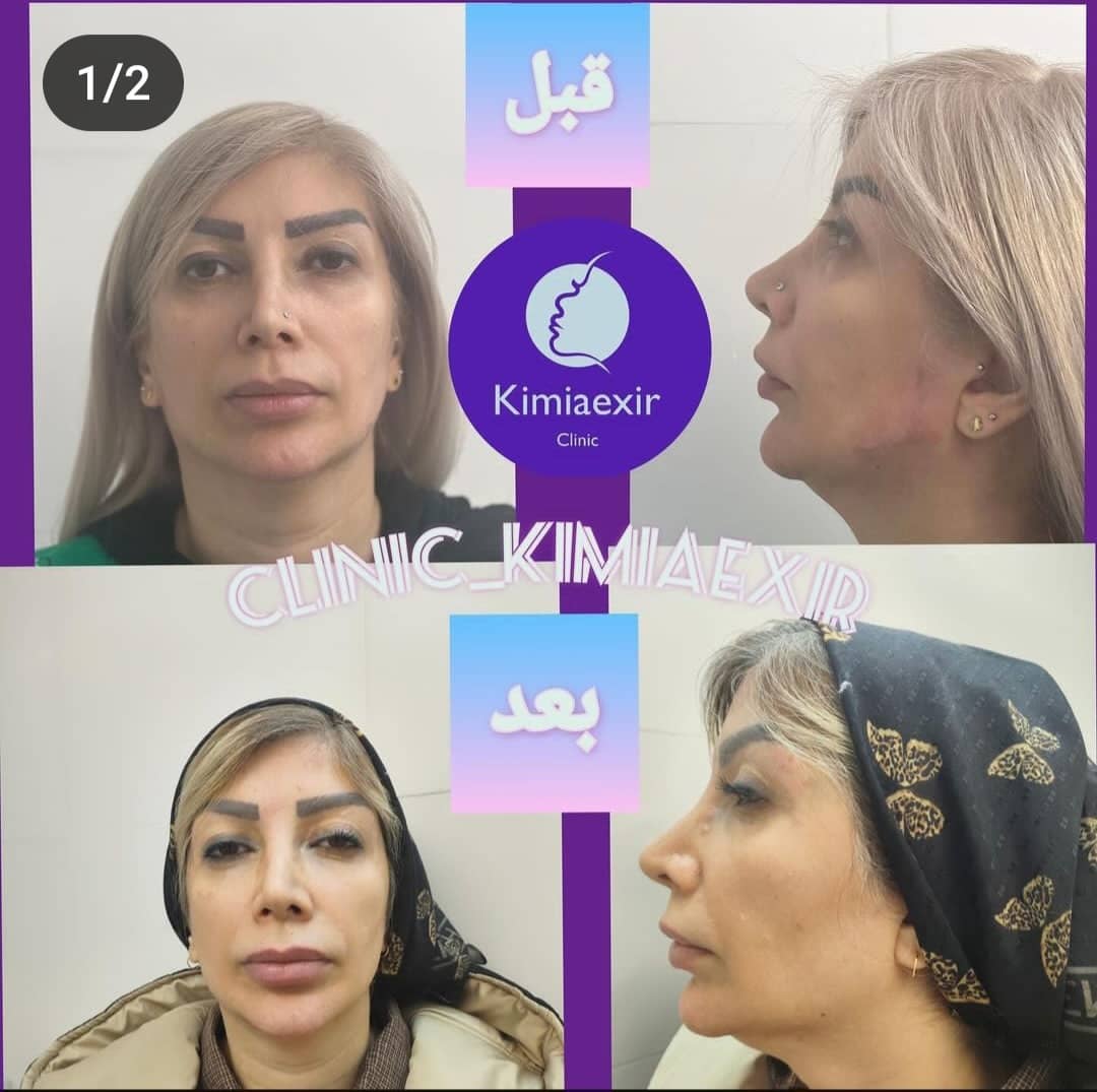 کلینیک زیبایی کیمیا اکسیر در تهرانپارس تهران