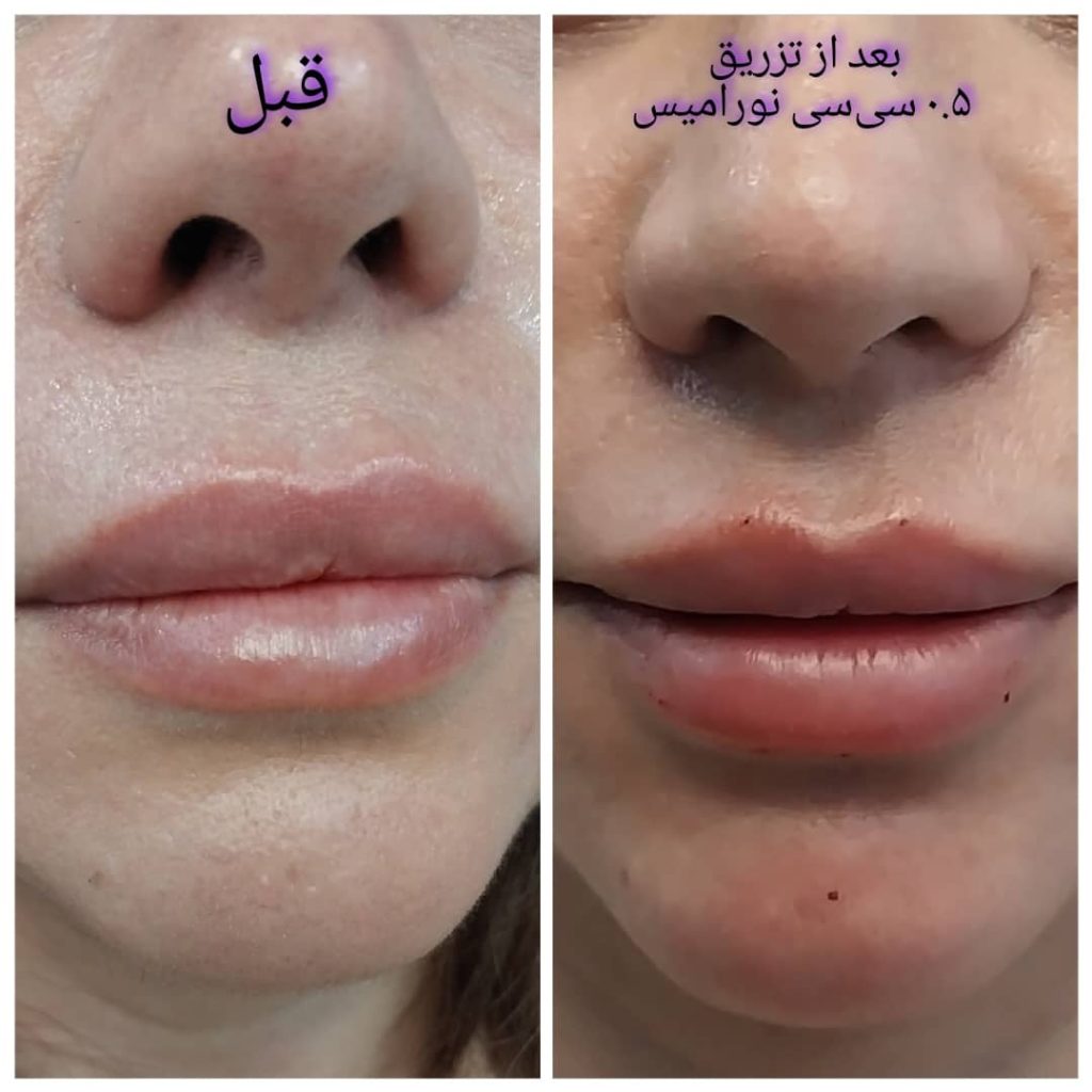 مطب شفا در صالحیه اسلامشهر