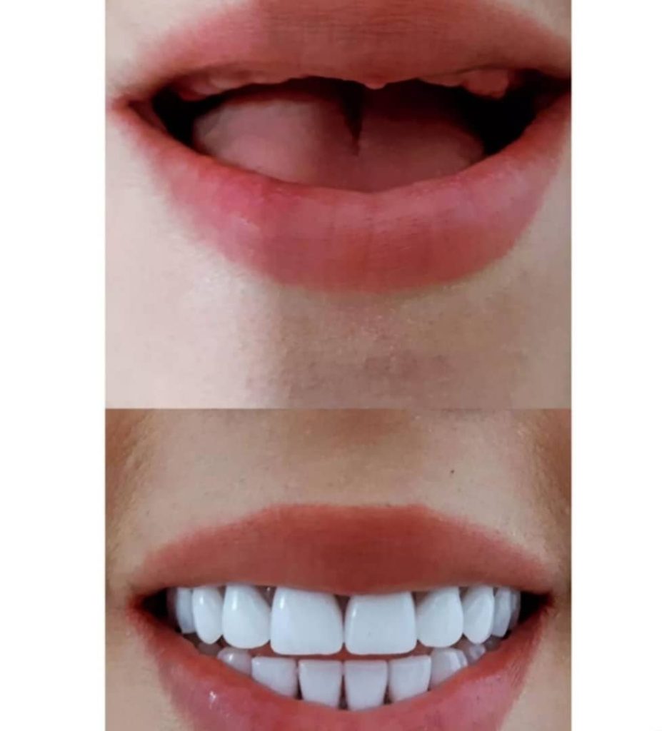 لابراتوار تخصصی دندان سازی و دیجیتال ایده آل در امام خمینی لنگرود