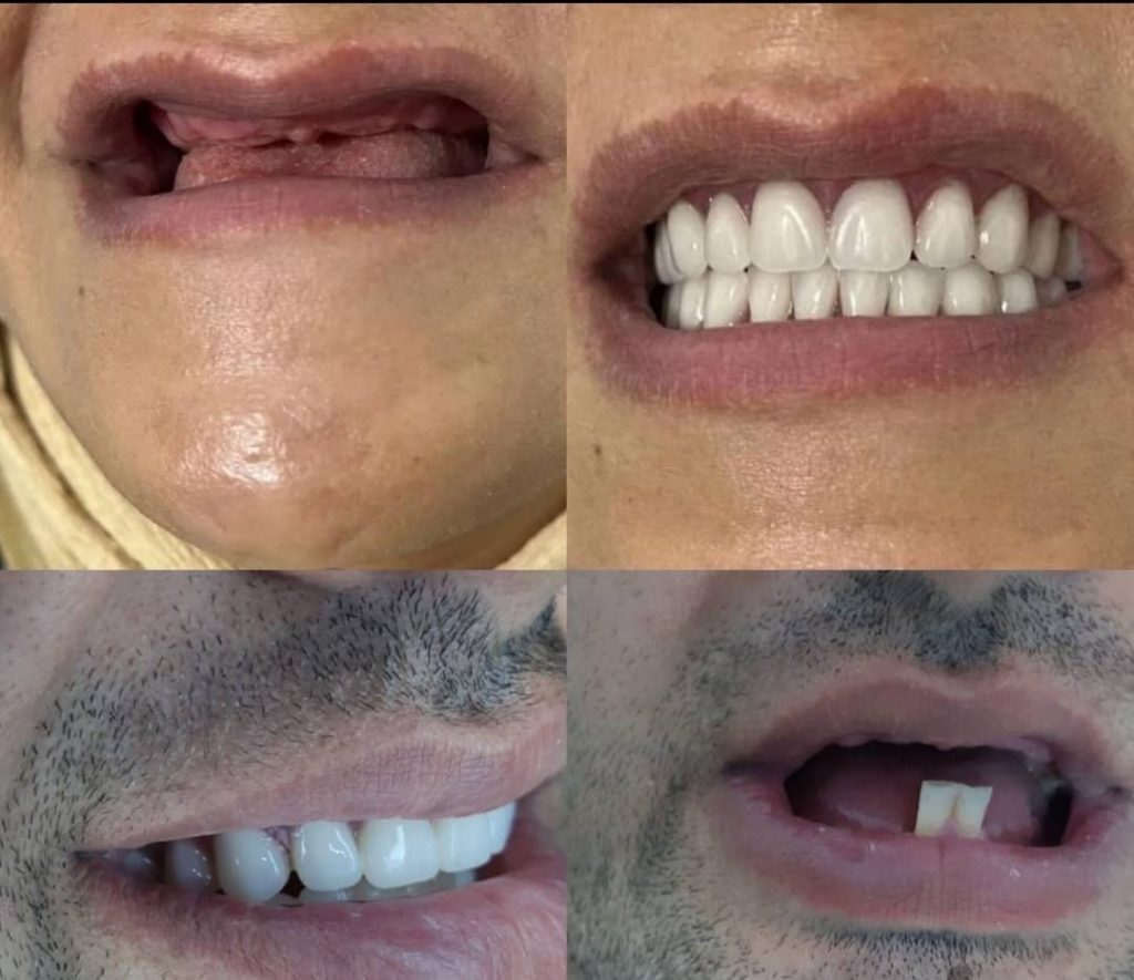 لابراتوار تخصصی دندان سازی و دیجیتال ایده آل در امام خمینی لنگرود