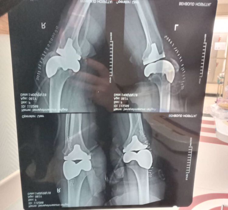 متخصص و جراح ارتوپدی دکتر علی هوشمند در تبریز