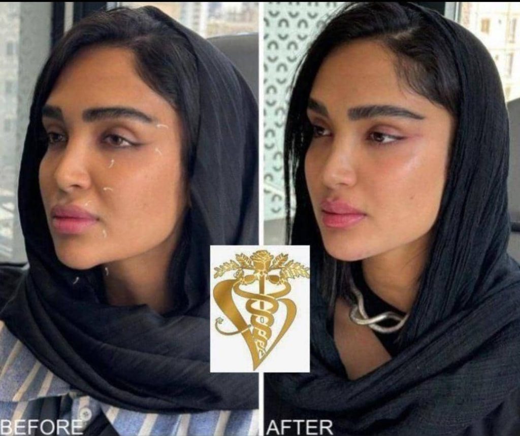 مرکز تخصصی تزریق ژل و بوتاکس وایتال فورس در 17 شهریور جدید تبریز