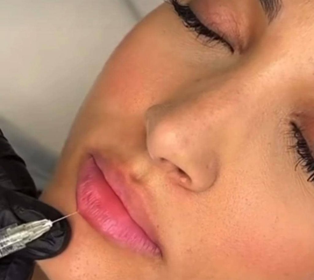 کلینیک تخصصی مزوتراپی صدف در کرج