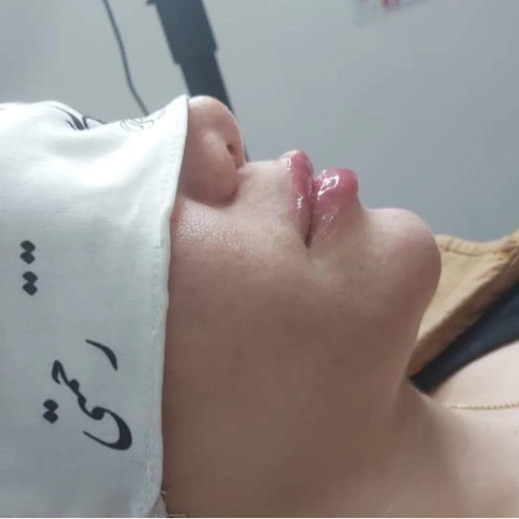 کلینیک پوست و مو رحمتی در ملارد