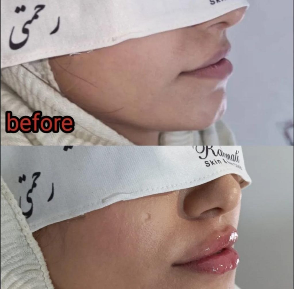 کلینیک پوست و مو رحمتی در ملارد