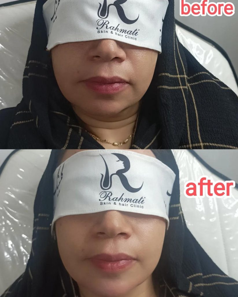 کلینیک پوست و مو رحمتی در ملارد