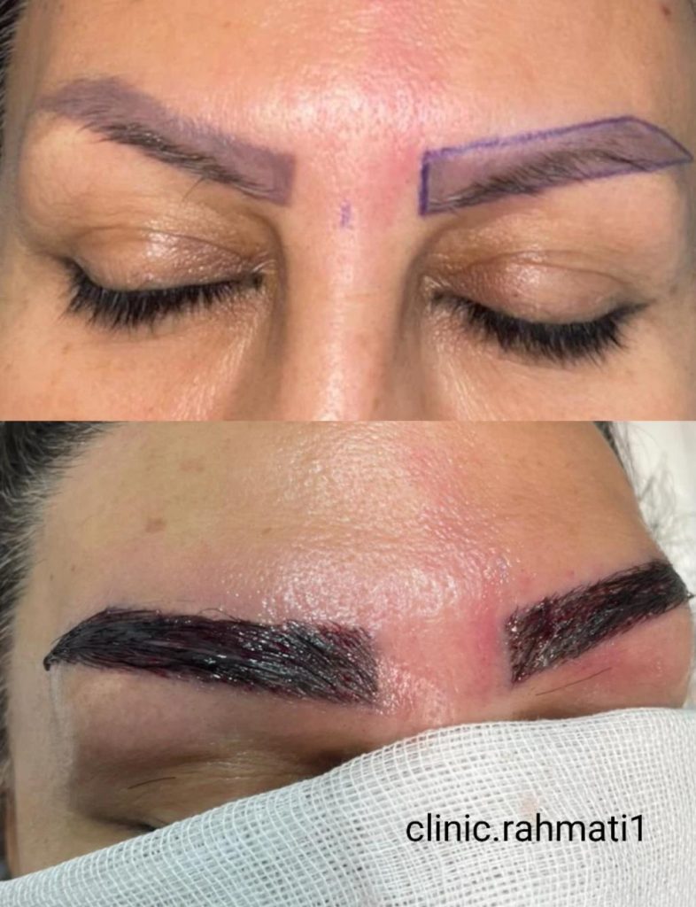 کلینیک پوست و مو رحمتی در ملارد