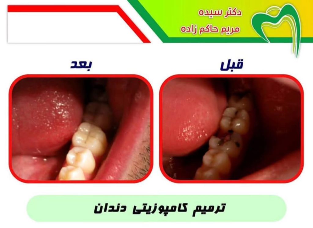 مطب دندانپزشکی دکتر حاکم زاده در سه راه اقدسیه تهران