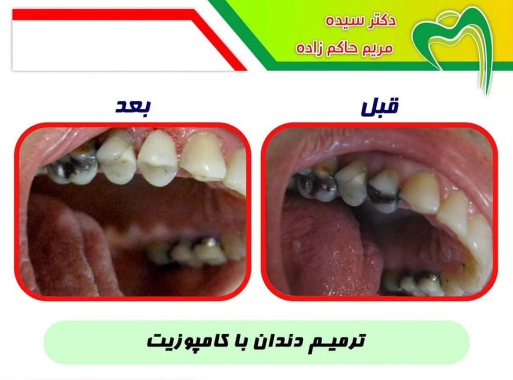 مطب دندانپزشکی دکتر حاکم زاده در سه راه اقدسیه تهران
