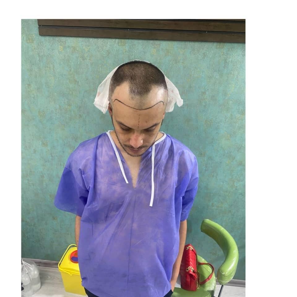 کلینیک تخصصی کاشت مو و ابرو هاشمی در تبریز