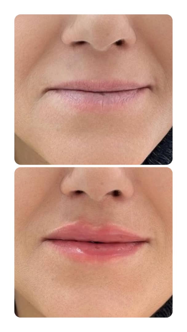 کلینیک زیبایی استار بیوتی سیرجان