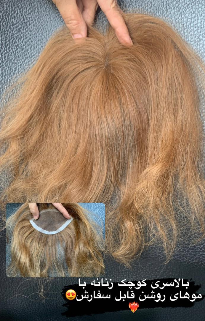 تولید عمده پروتز مو طبیعی جلوسری بالاسری تمام سری gilan wig تهران