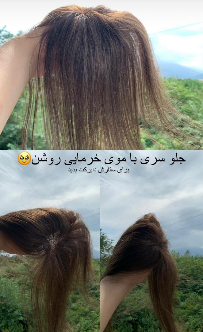 تولید عمده پروتز مو طبیعی جلوسری بالاسری تمام سری gilan wig تهران