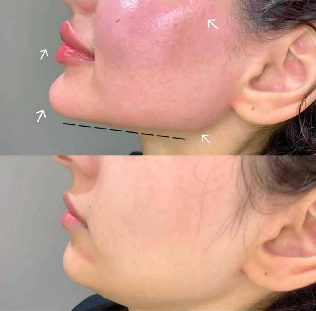 خدمات تخصصی زیبایی لیزر موهای زائد مرکز تخصصی ایپک در تبریز