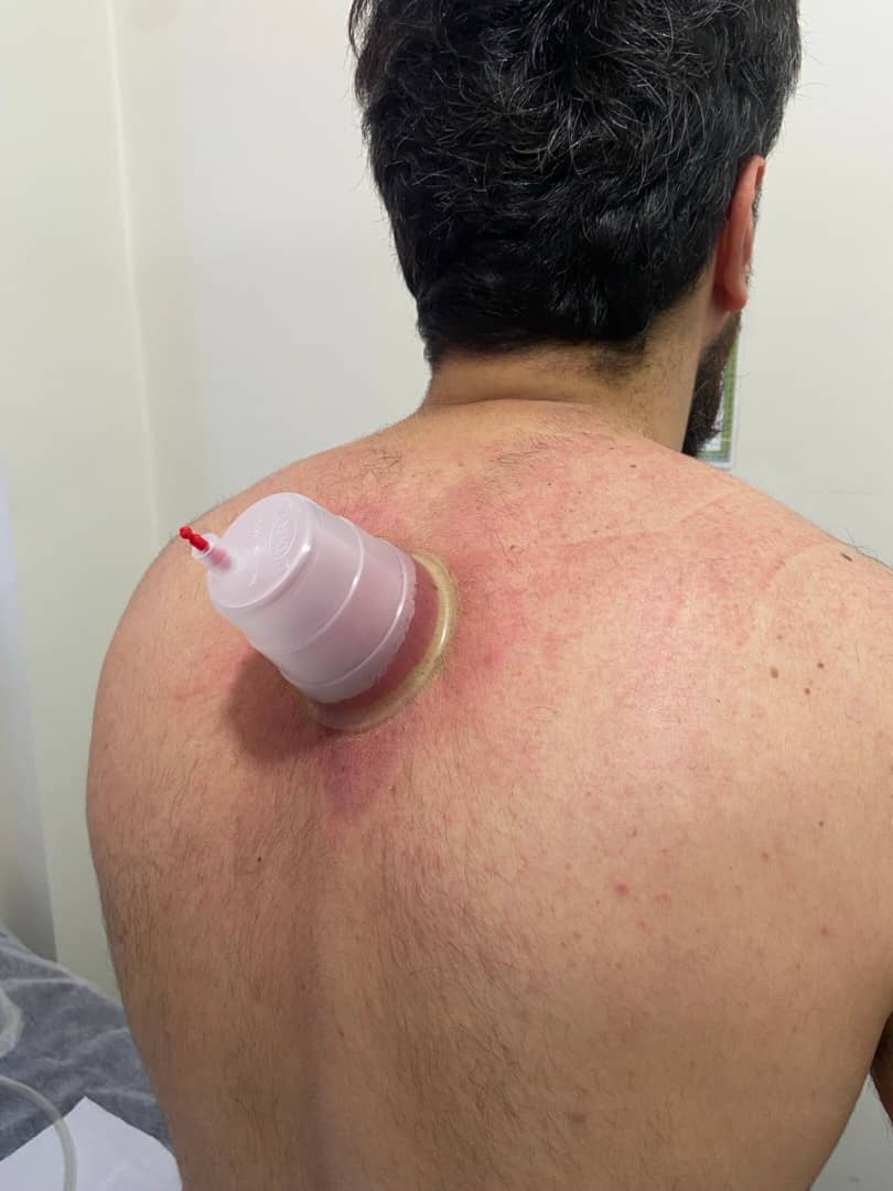 طب سنتی صفا در تبریز