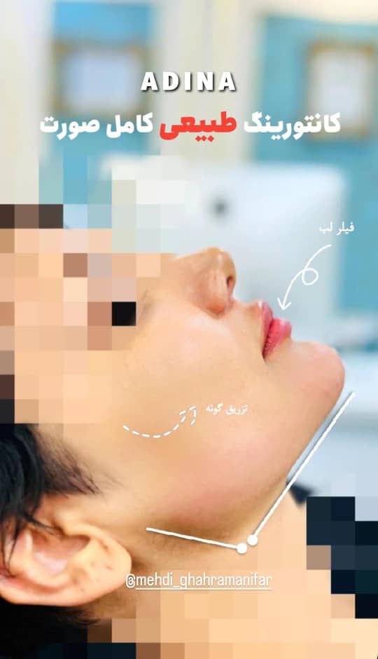 کلینیک زیبایی بین المللی آدینا در شصت متری یاسوج