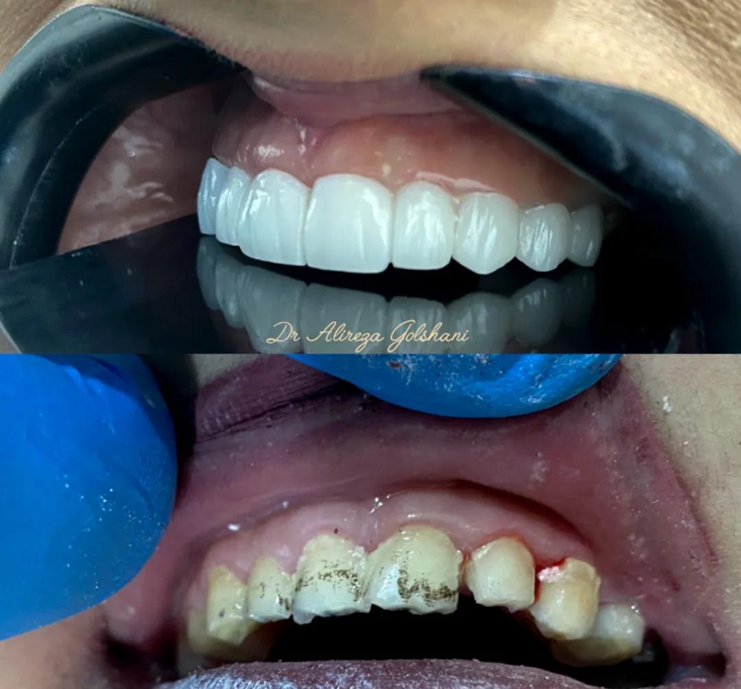 مطب دندانپزشکی دکتر علیرضا گلشنی در هفده شهریور جدید تبریز