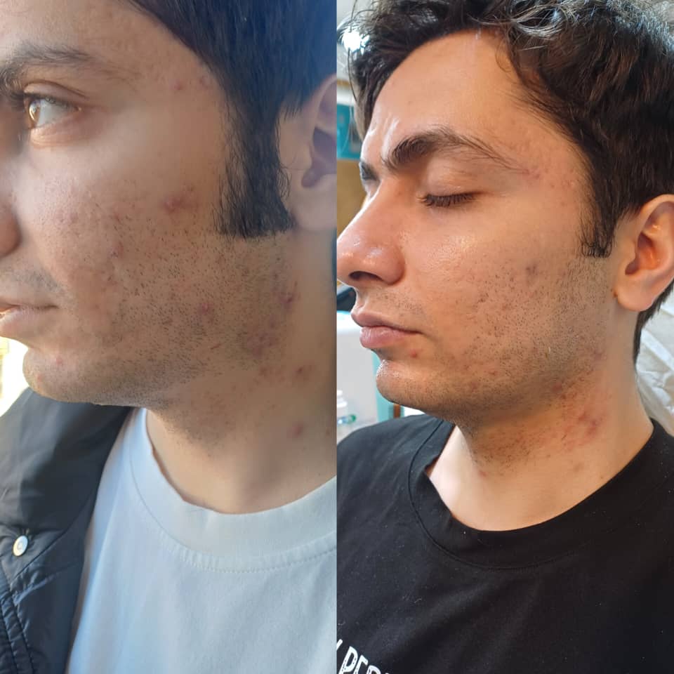 آموزش و خدمات پاکسازی پوست VIP آقایان درشافیشال در اصفهان