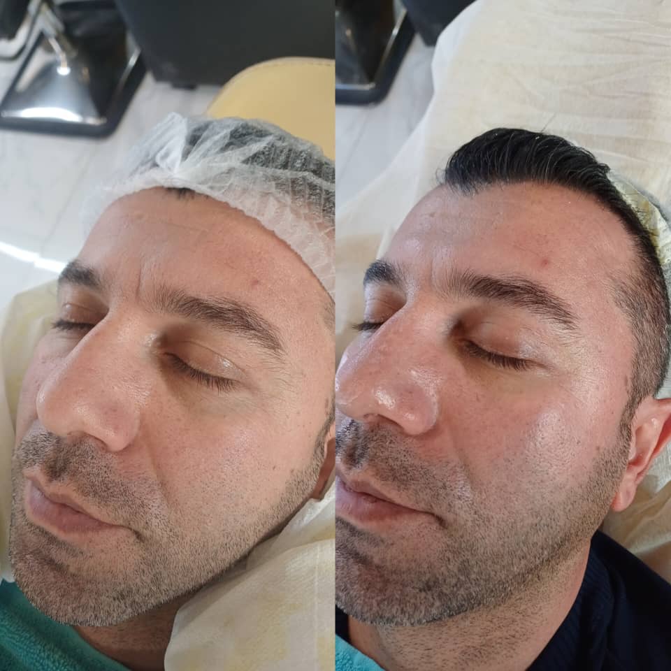 آموزش و خدمات پاکسازی پوست VIP آقایان درشافیشال در اصفهان