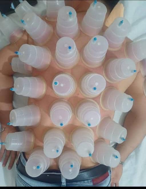 خدمات تخصصی حجامت و رگ گیری گل نرگس جمالی در شیراز