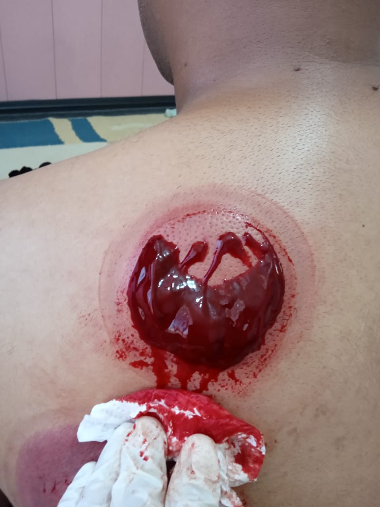 خدمات تخصصی حجامت و رگ گیری گل نرگس جمالی در شیراز