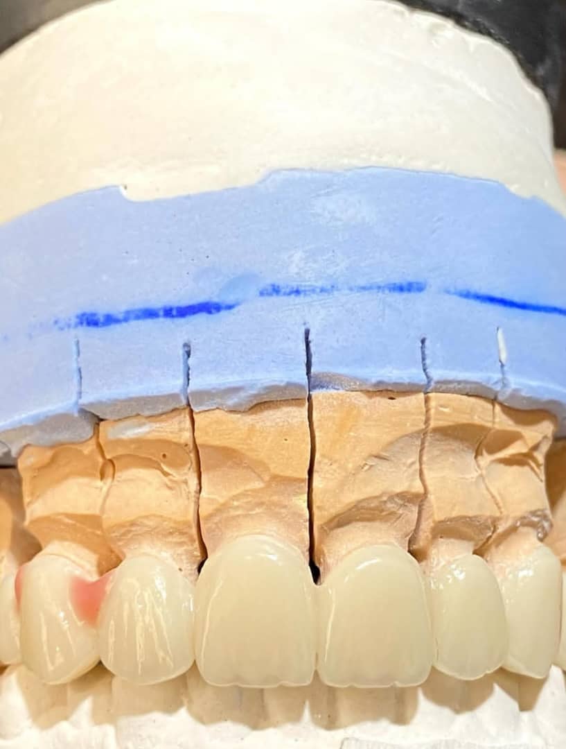 لابراتوار تخصصی پروتزهای دندانی ثابت پادار در ارومیه