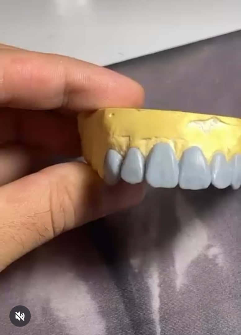 لابراتوار تخصصی پروتزهای دندانی ثابت پادار در ارومیه