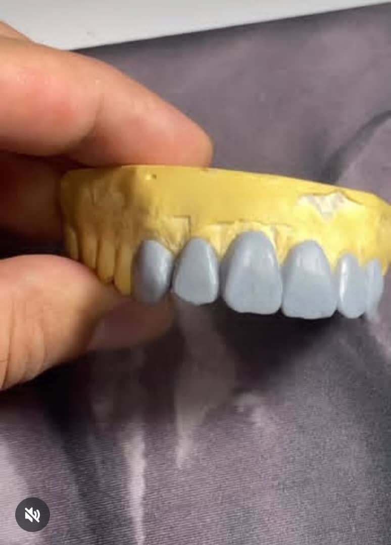 لابراتوار تخصصی پروتزهای دندانی ثابت پادار در ارومیه