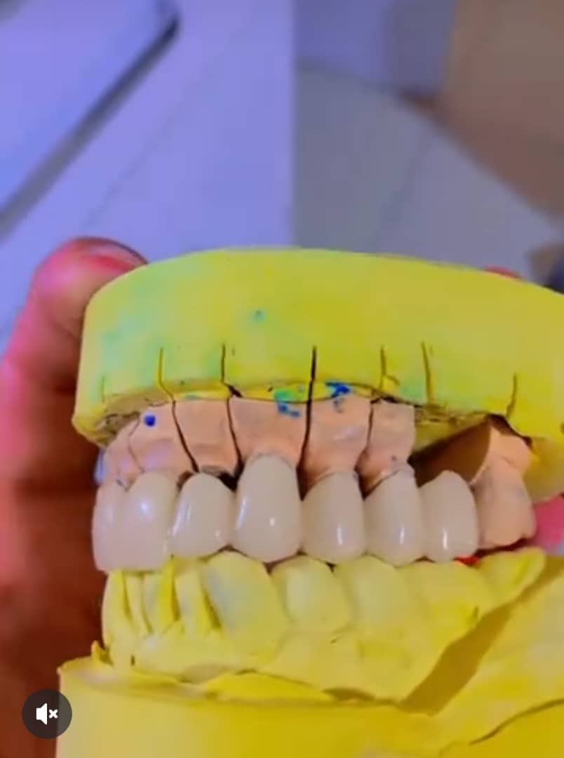 لابراتوار تخصصی پروتزهای دندانی ثابت پادار در ارومیه