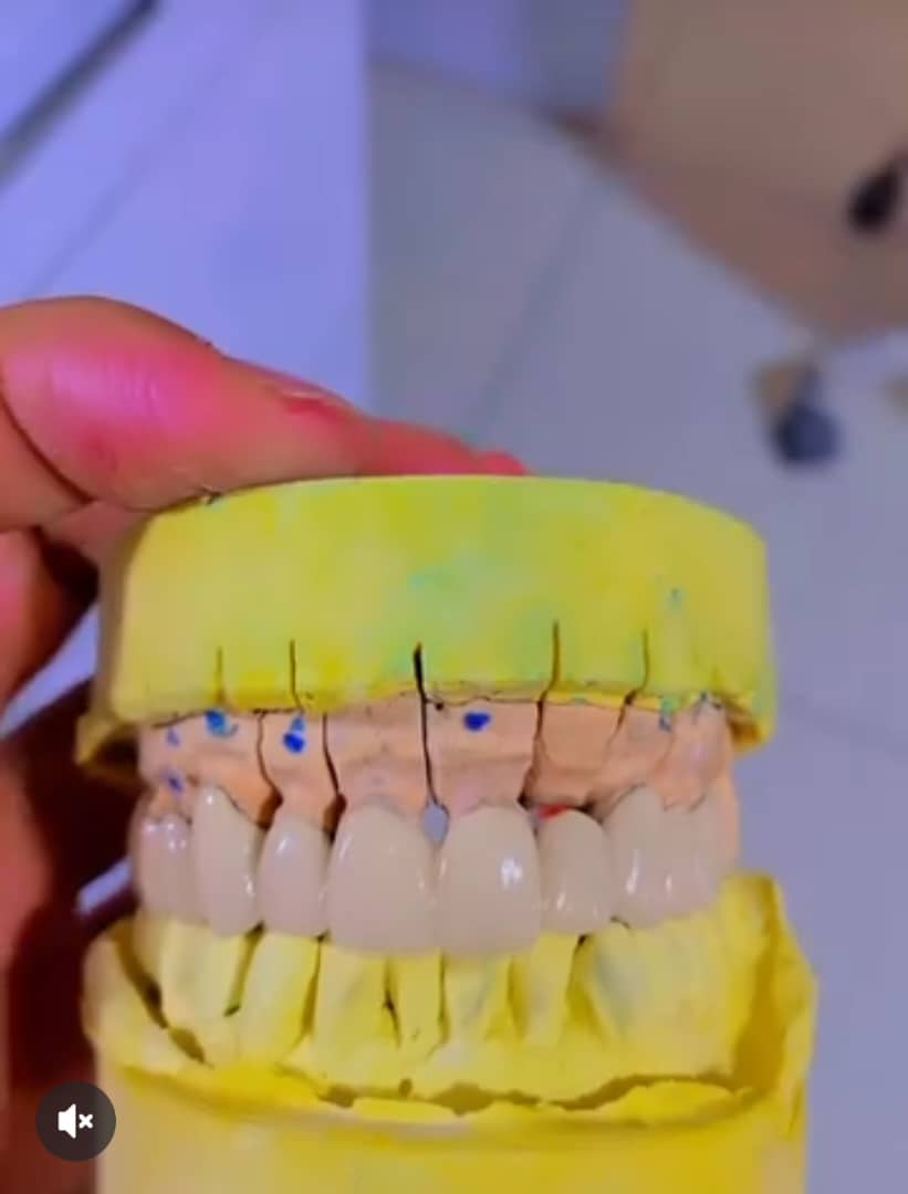 لابراتوار تخصصی پروتزهای دندانی ثابت پادار در ارومیه