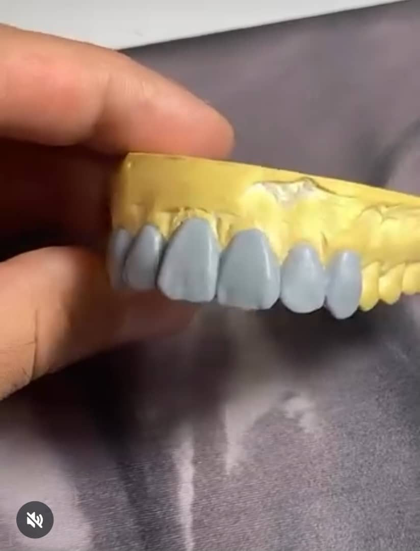 لابراتوار تخصصی پروتزهای دندانی ثابت پادار در ارومیه